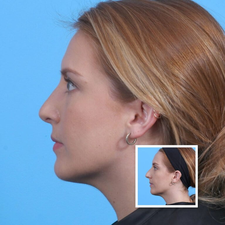 Artboard 1 copy 3-min