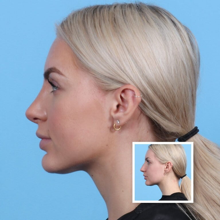 Artboard 1 copy 5-min