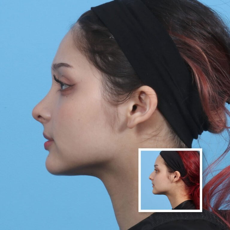 Artboard 1 copy 6-min